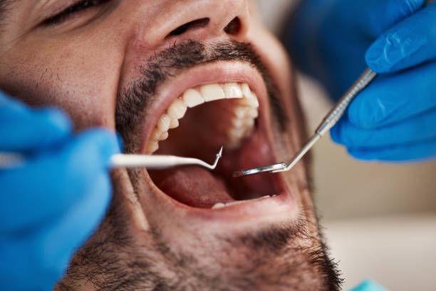 Best Urgent Tooth Repair  in Hernando, MS