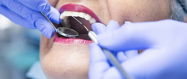 Best Chipped Tooth Repair Near Me  in Hernando, MS